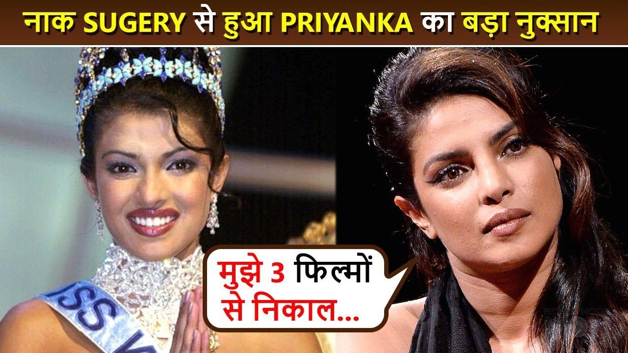 Surgery Gone Wrong...Priyanka Chopra's SHOCKING Confession On Her Nose Job