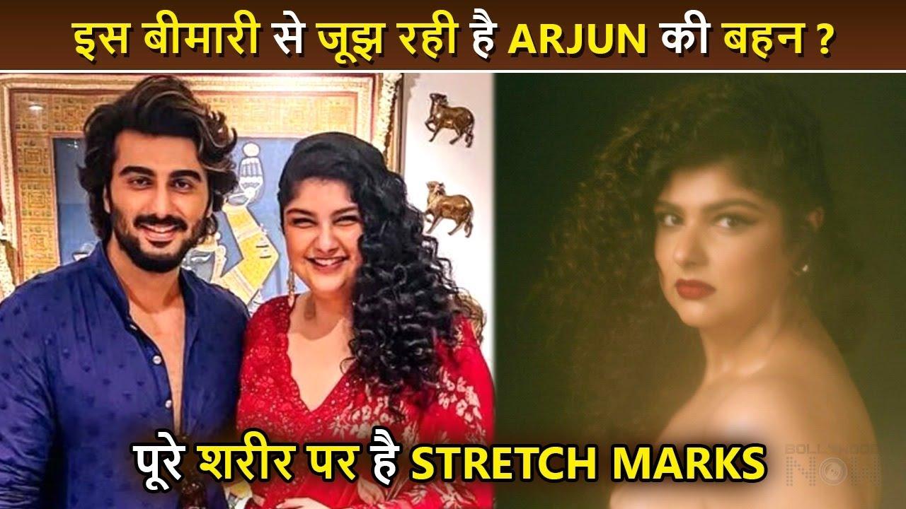 Shocking! Arjun Kapoor's Sister Anshula Kapoor Suffering From This Disease ?