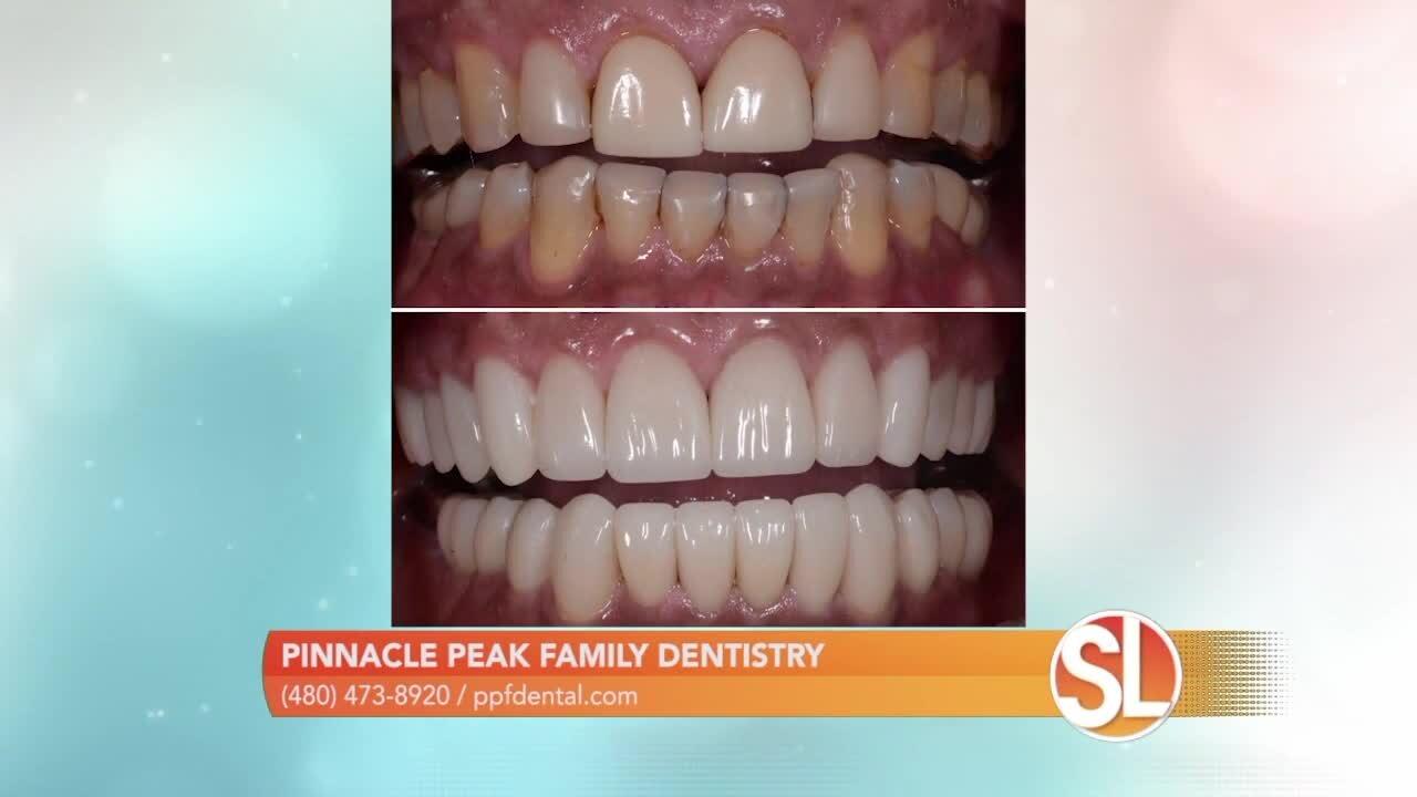 Pinnacle Peak Family Dentistry Creating One News Page VIDEO
