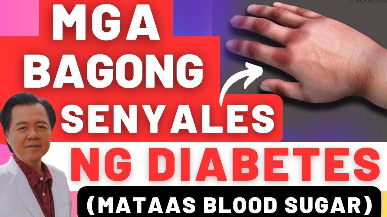 Mga Bagong Senyales ng Diabetes (Mataas Blood Sugar) - By Doc Willie Ong