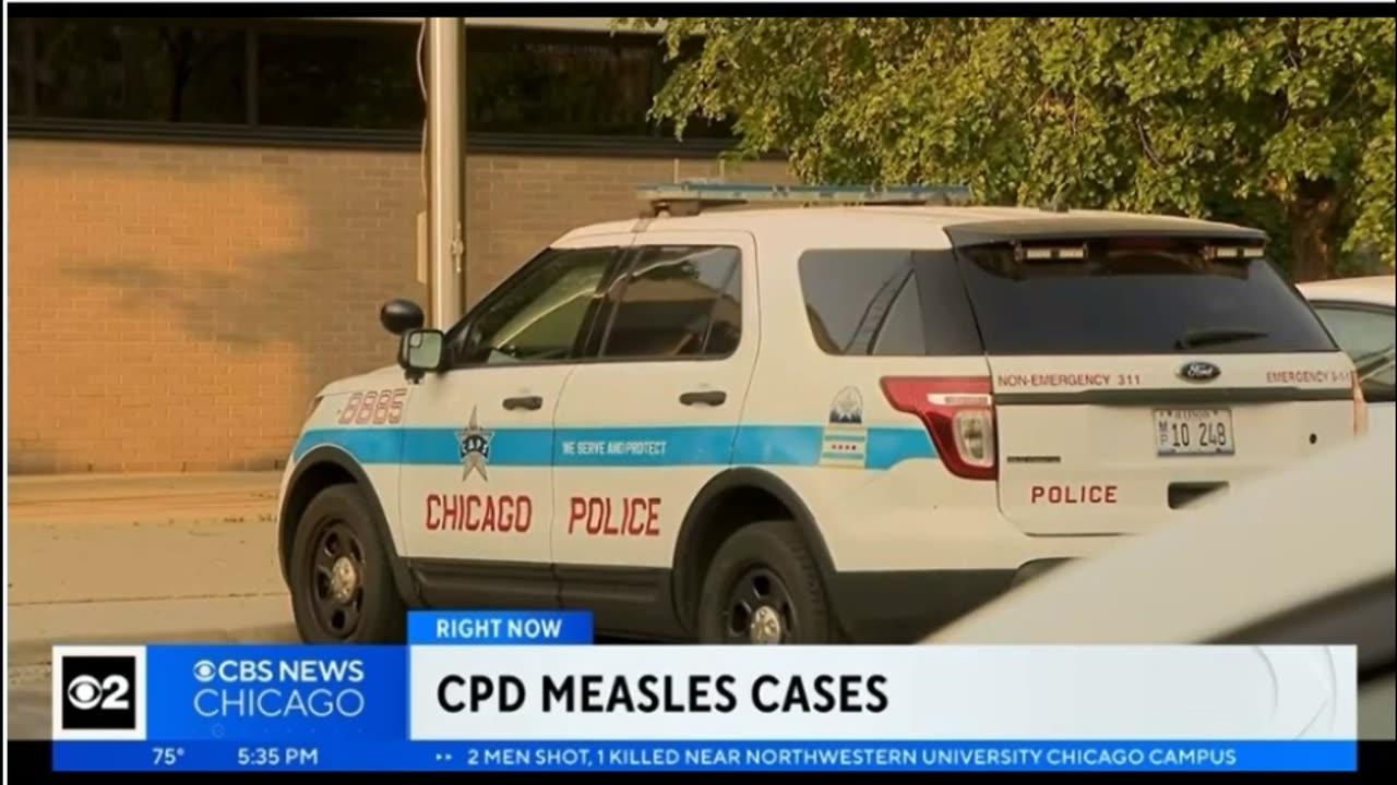 Chicago Police Department suffers an Measles Outbreak - Thank You Open Borders