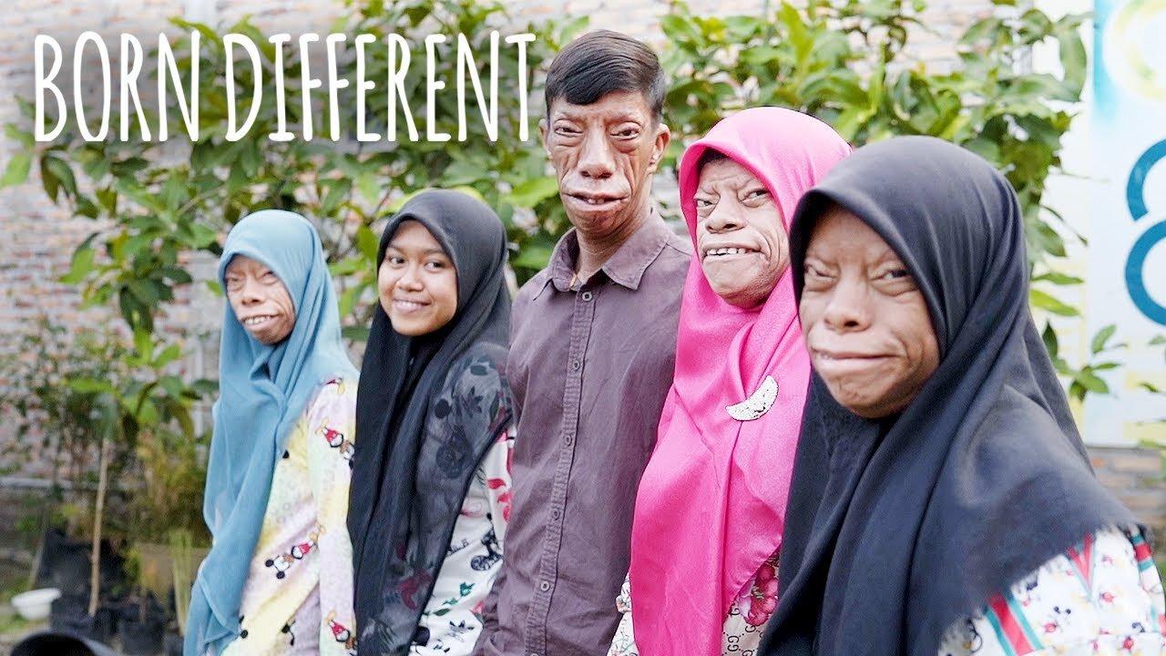 The Family Whose Faces Change Shape