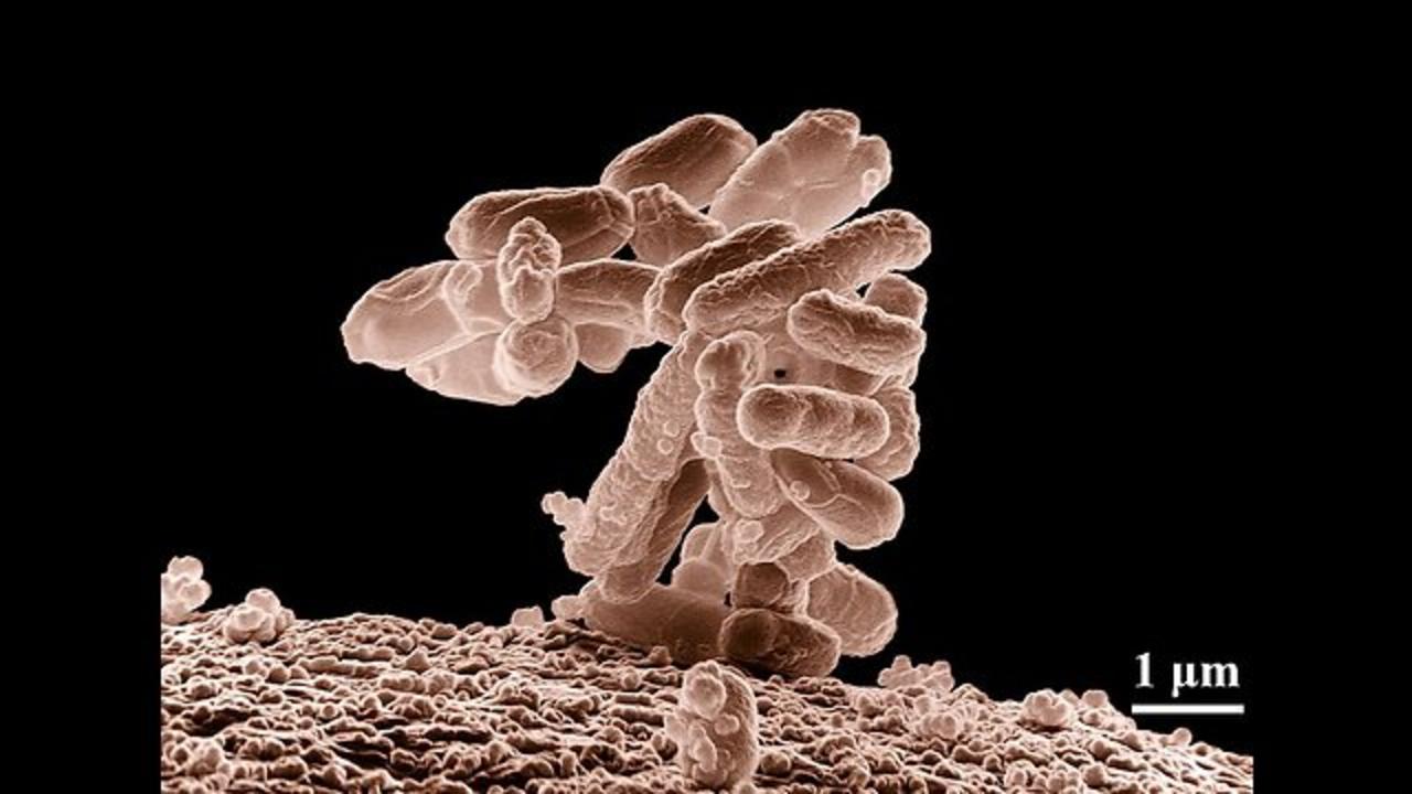 Escherichia coli-derived virus-like particles in vaccine development