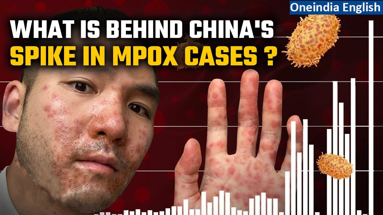 Mpox: China reels under sudden spurt of the disease; Sees massive spike in cases | Oneindia News