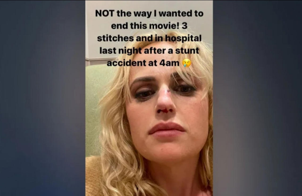 Rebel Wilson needed stitches after a 'stunt accident' on the set of 'Bride Hard'