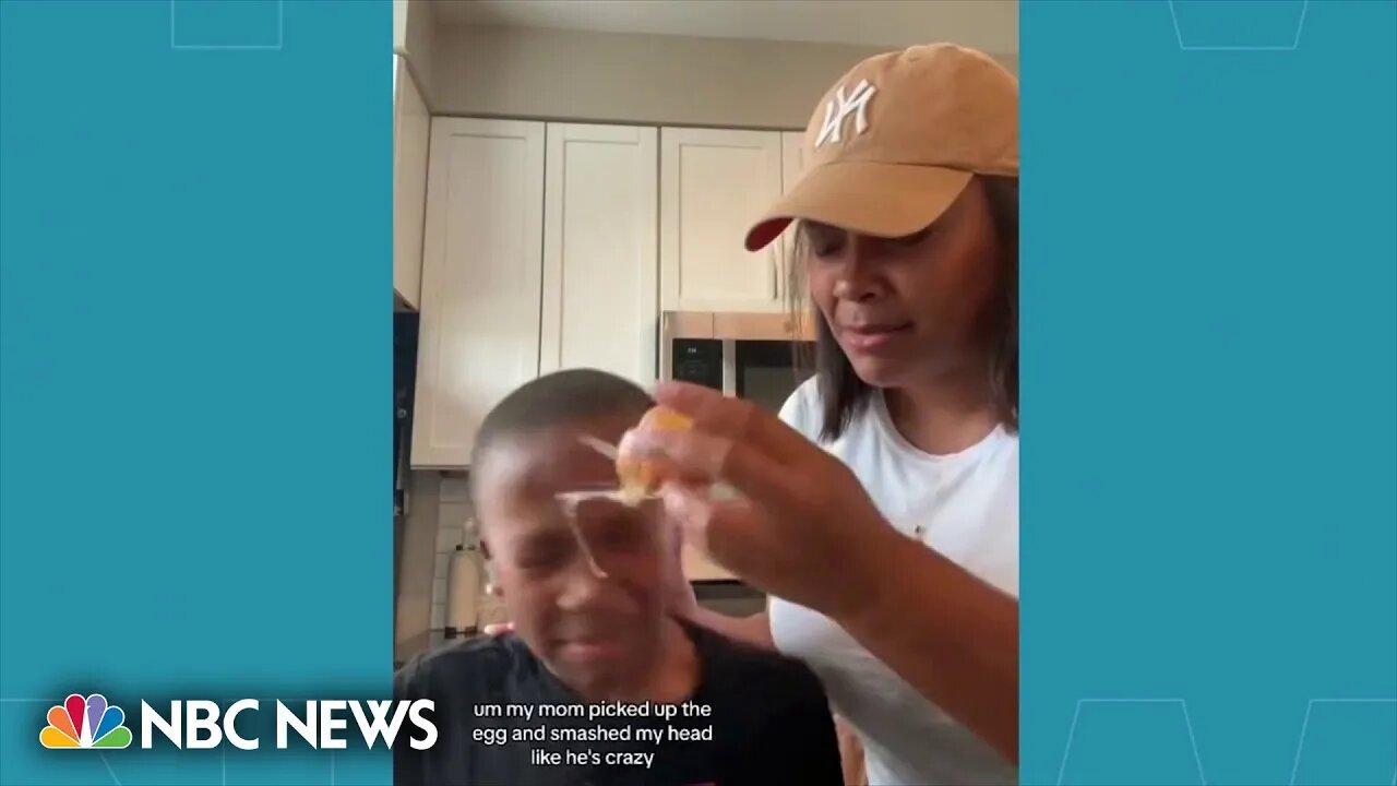 Doctors warn against TikTok trend of parents cracking an egg on their kids’ head
