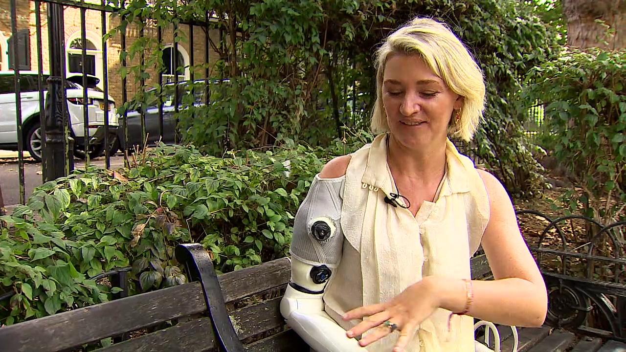 London mother shows off groundbreaking bionic arm