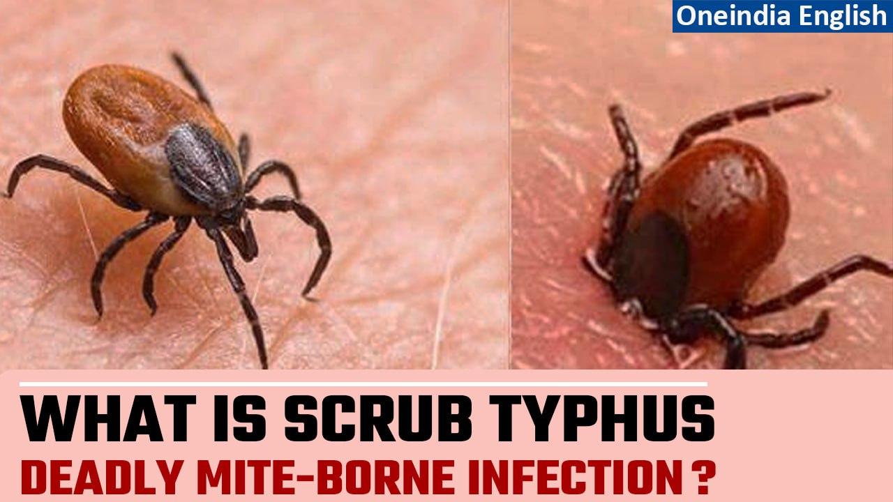 Scrub Typhus kills 5 in Odisha, 9 in Shimla | Know about this deadly infection | Oneindia News
