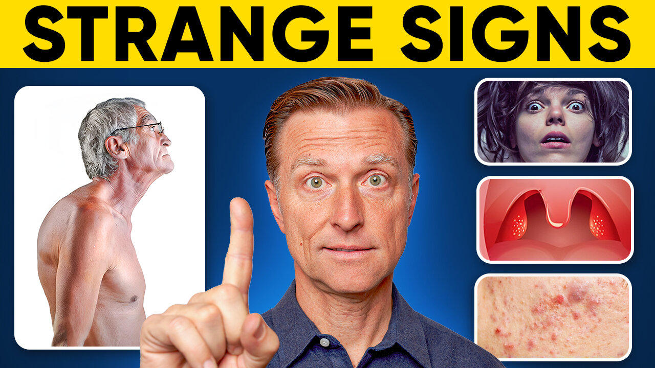 23 WEIRD Vitamin D Deficiency Symptoms One News Page VIDEO