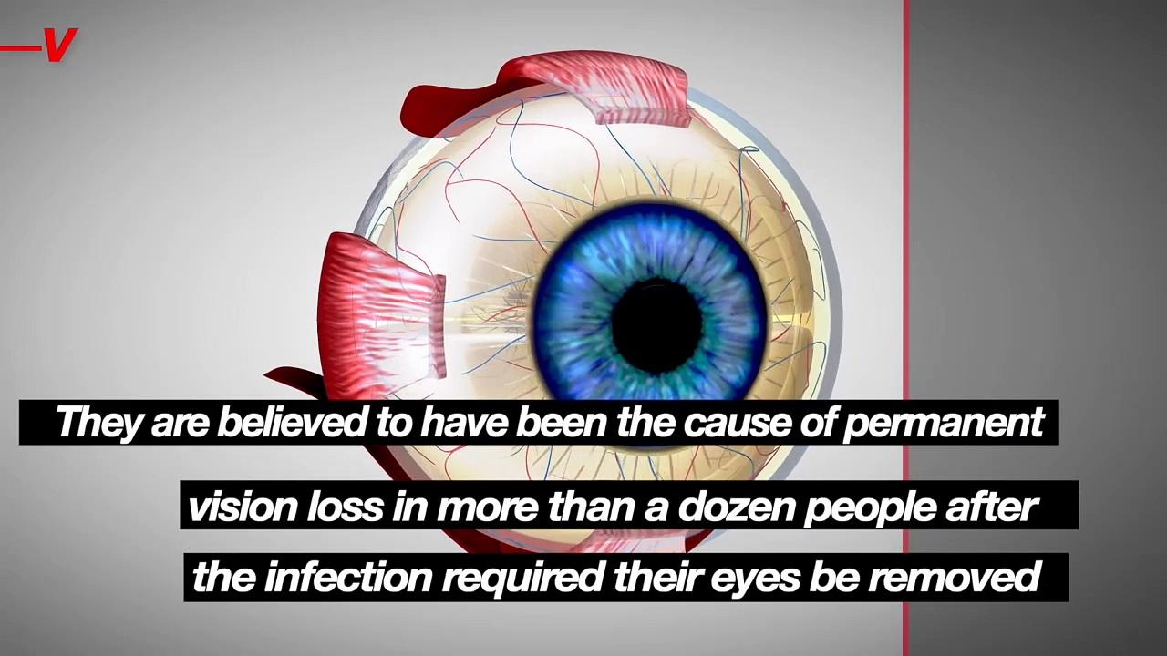 FDA and CDC Issue Warning Related to a Deadly Bacterial Outbreak Related to Eye Drops