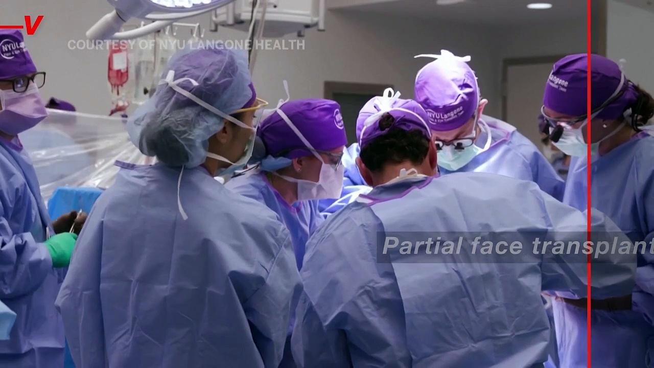 Surgeons Have Performed the World’s First Eye Transplant