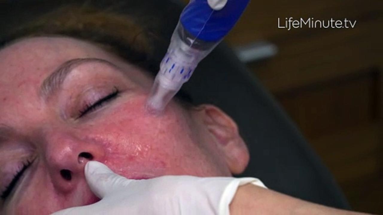 The Next Era in Skin Health is Here: New Study Reveals Remarkable Results in Aesthetic Treatment Recovery