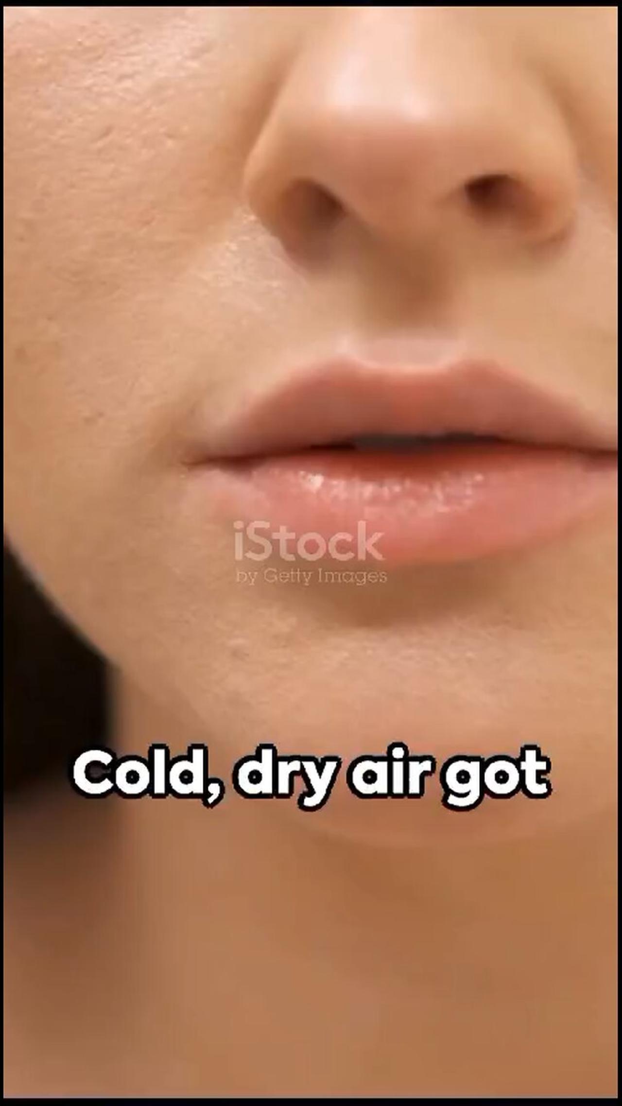 Ways to stop your lips from getting dry One News Page VIDEO