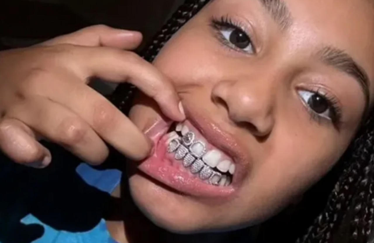 North West flaunted a set of diamond teeth grills after Kanye West showed off his metallic ‘dentures’