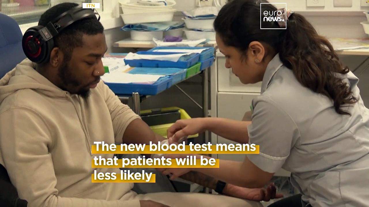 UK NHS is offering a world first 'blood matching' test to treat sickle cell patients