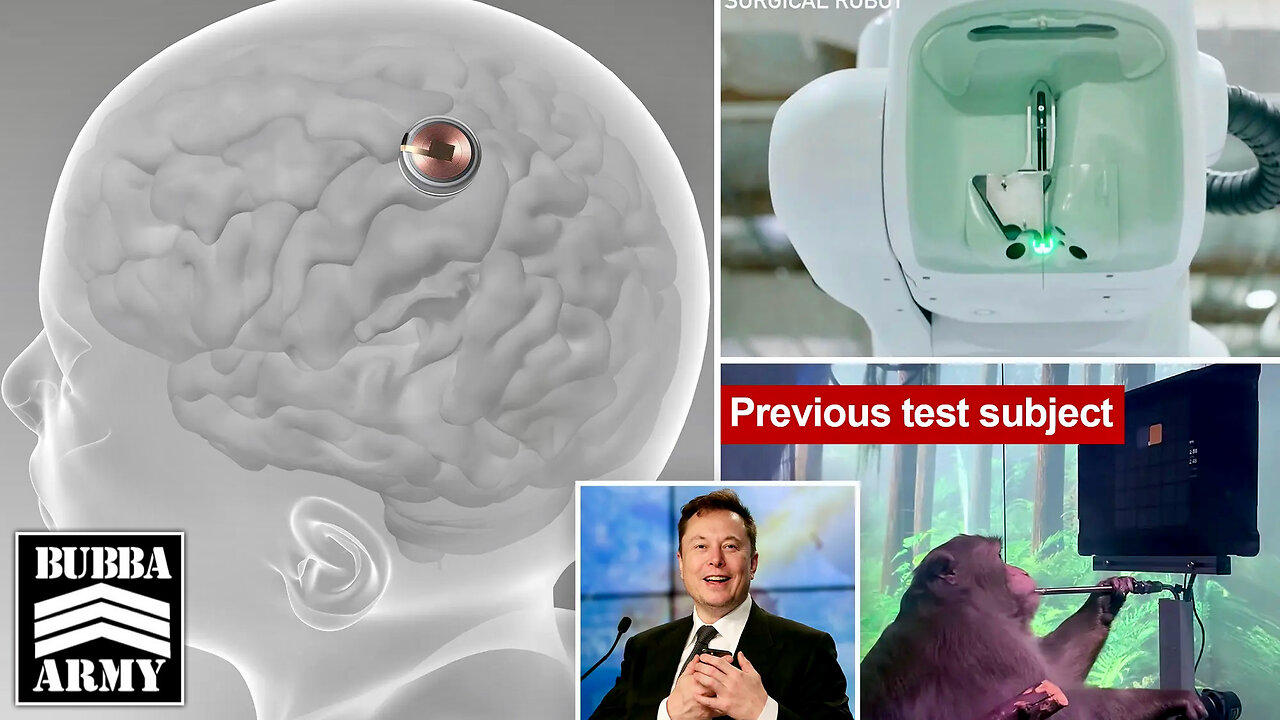 Elon Musk's Neuralink Implants First Chip in Human - Bubba the Love Sponge® Show | 1/30/24