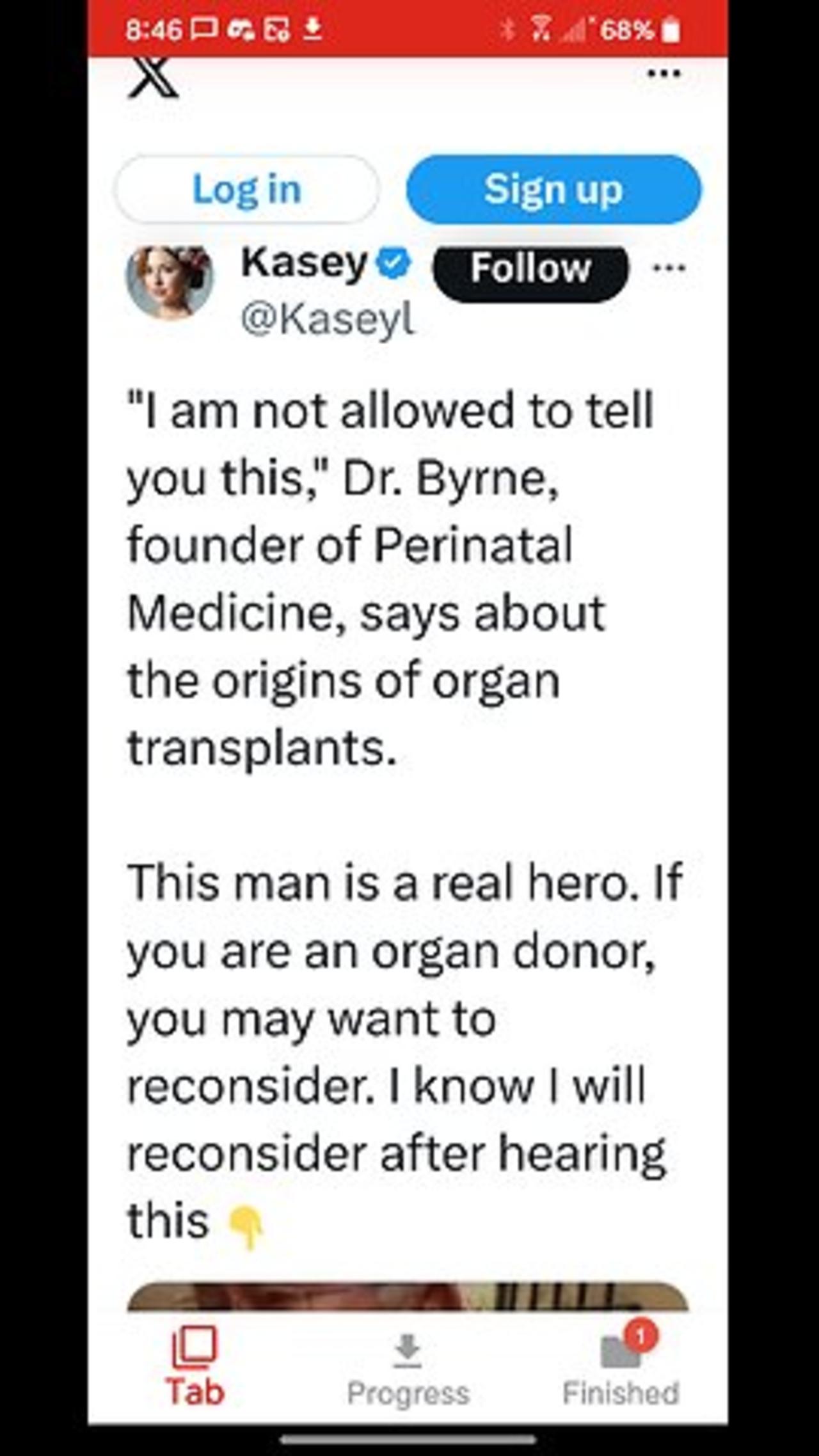 Dr. Byrne on Brain Death & Organ Donation