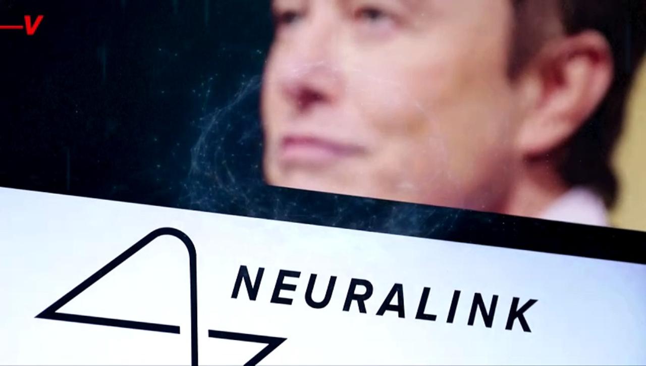 Poll Finds Very Few Americans Would Actually Want a Neuralink Implant Right Now
