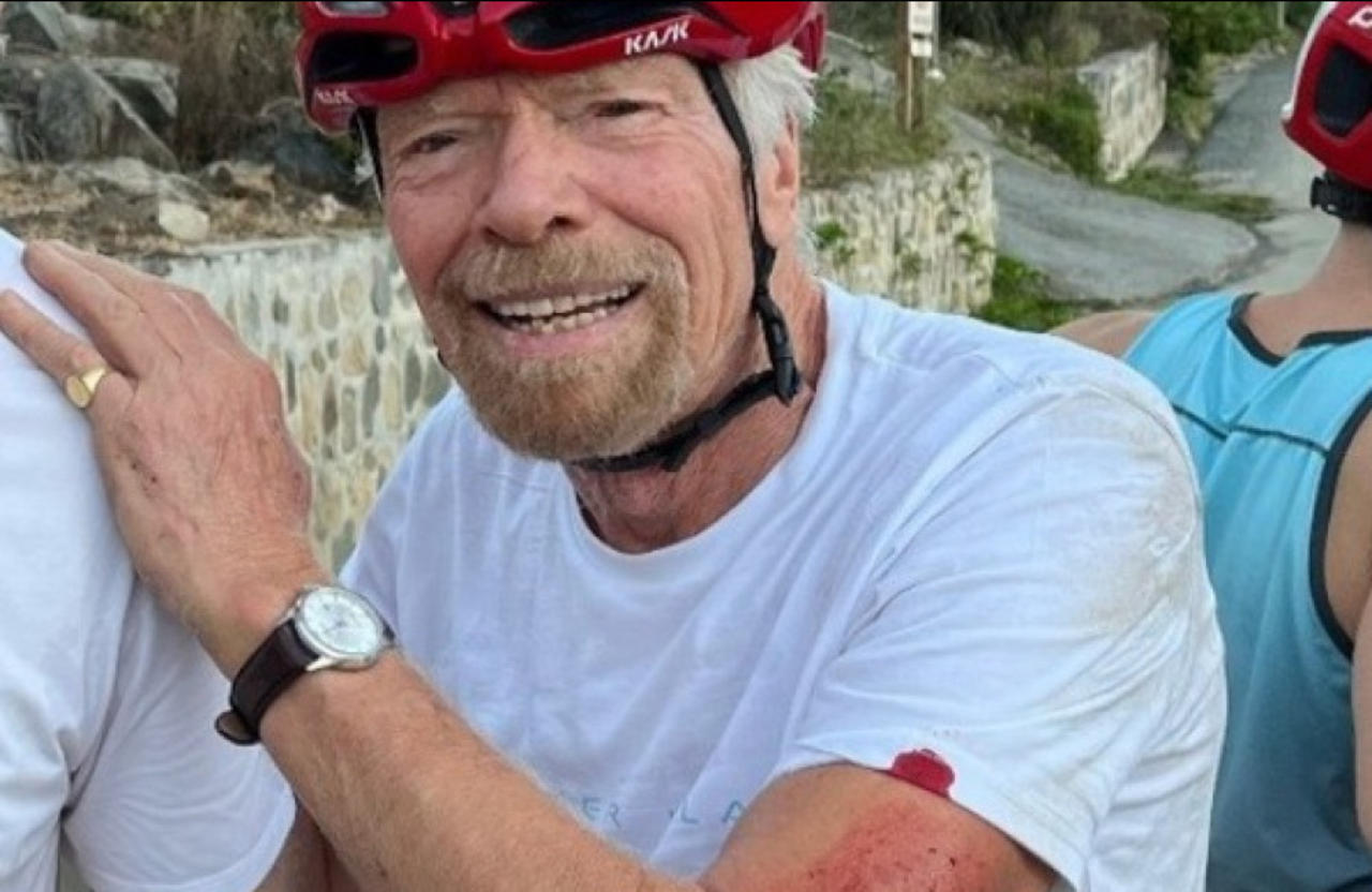 Sir Richard Branson left bloodied and bruised after cycling accident