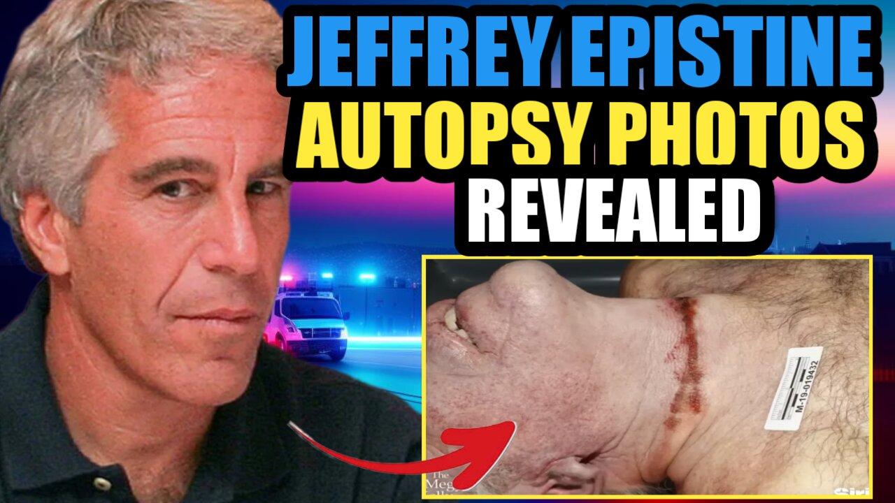 Never-Before-Seen Autopsy Photo of Jeffrey Epstein's Neck, with Epstein's brother Mark