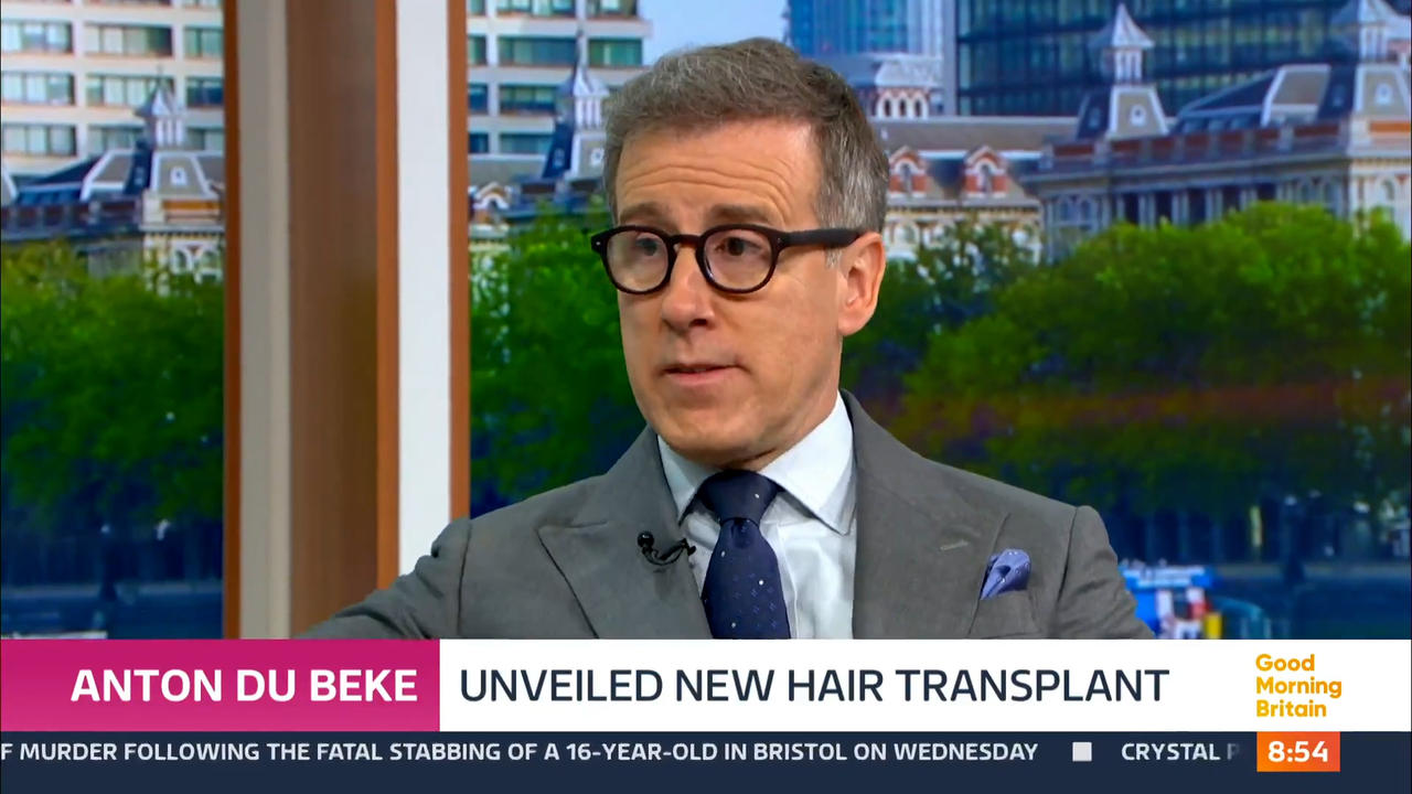 Strictly's Anton Du Beke says getting hair transplant was best thing he's ever done