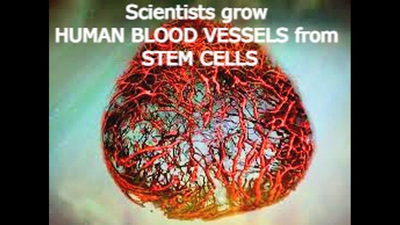 Scientists grow human blood vessels from stem cells in a dish
