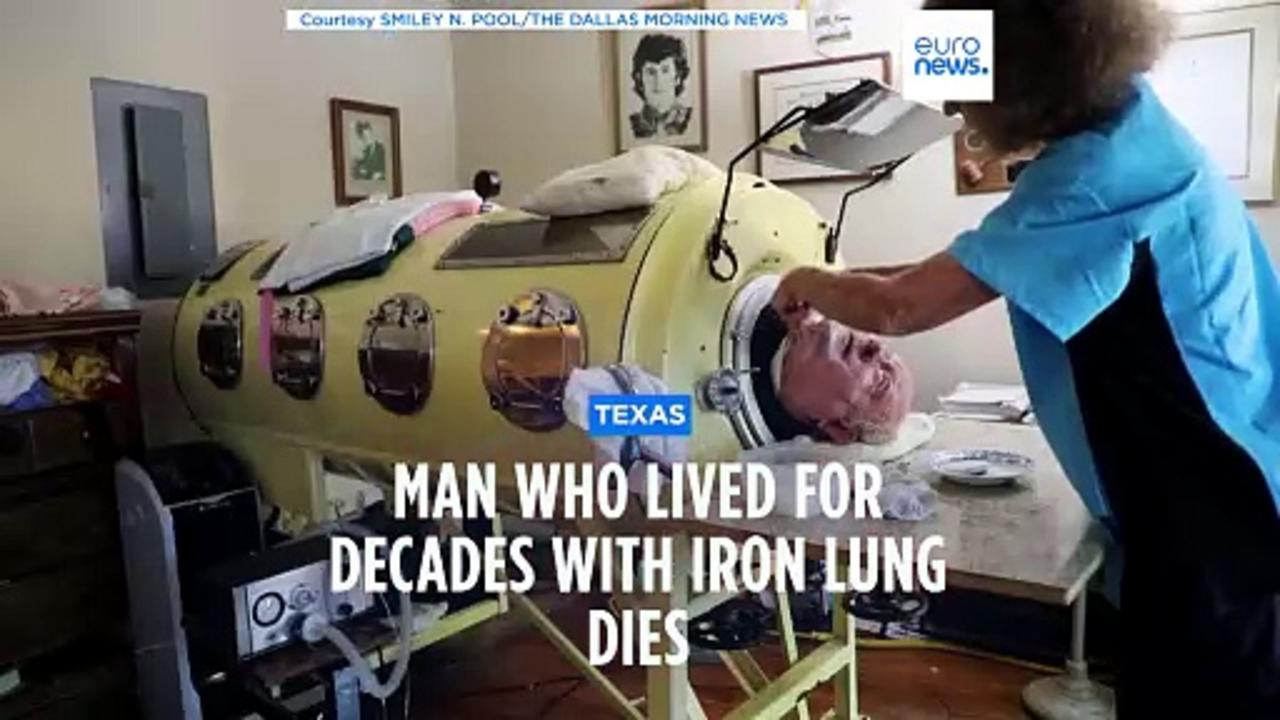 Paul Alexander, the 'man in the iron lung', dies aged 78