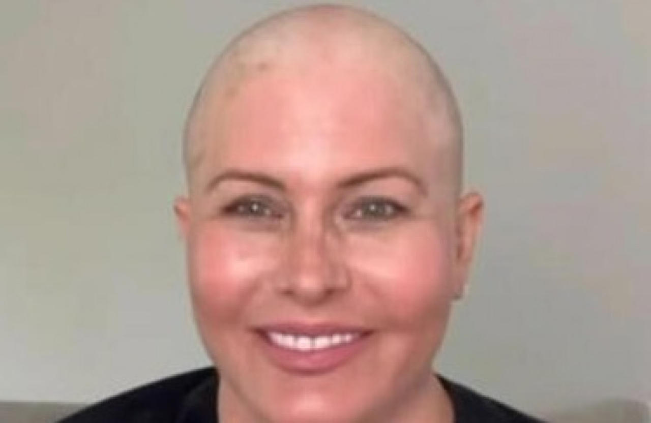 Cancer-stricken Baywatch star Nicole Eggert shaves head: 'Stay one step ahead of ur fears'