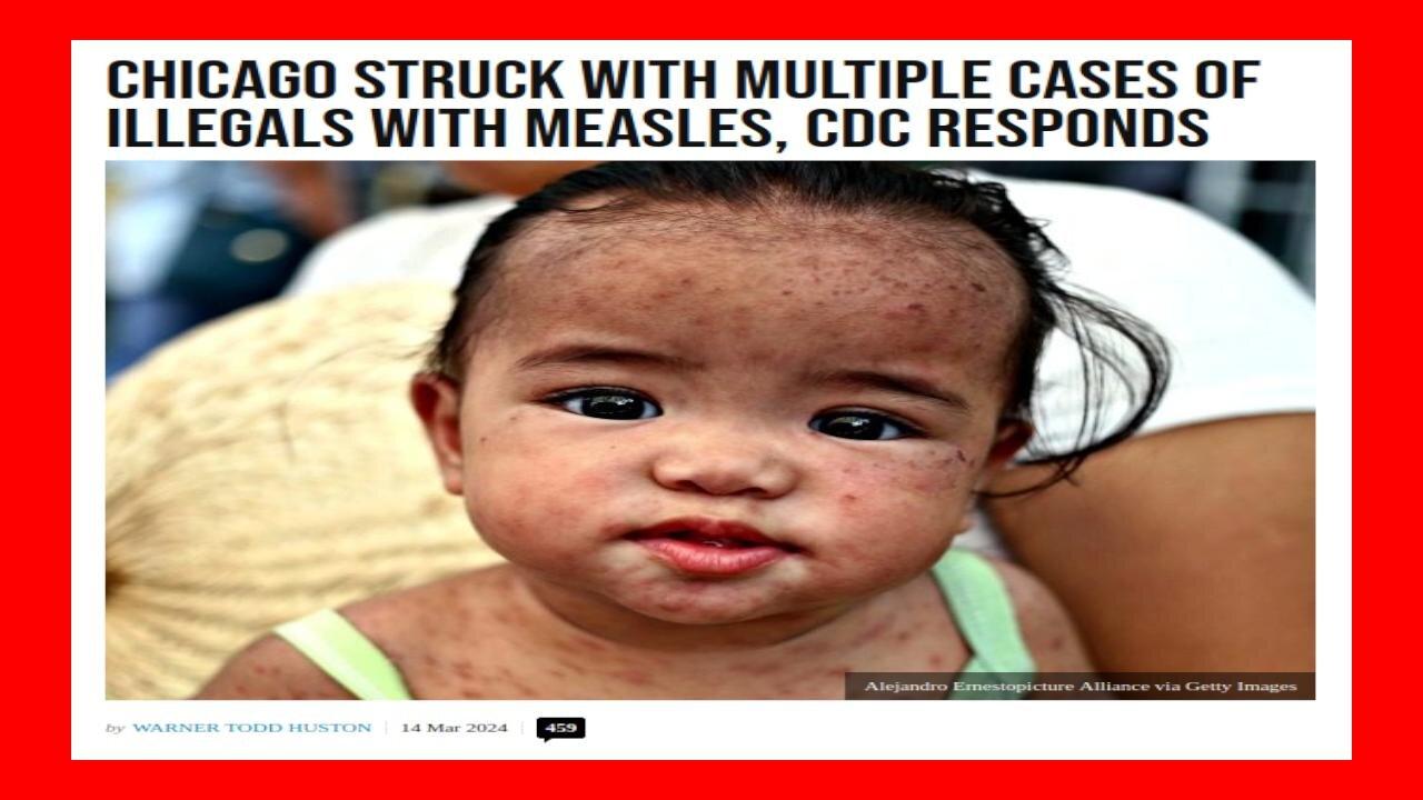 CDC Responds to ILLEGALS Struck With Measles in CHICAGO