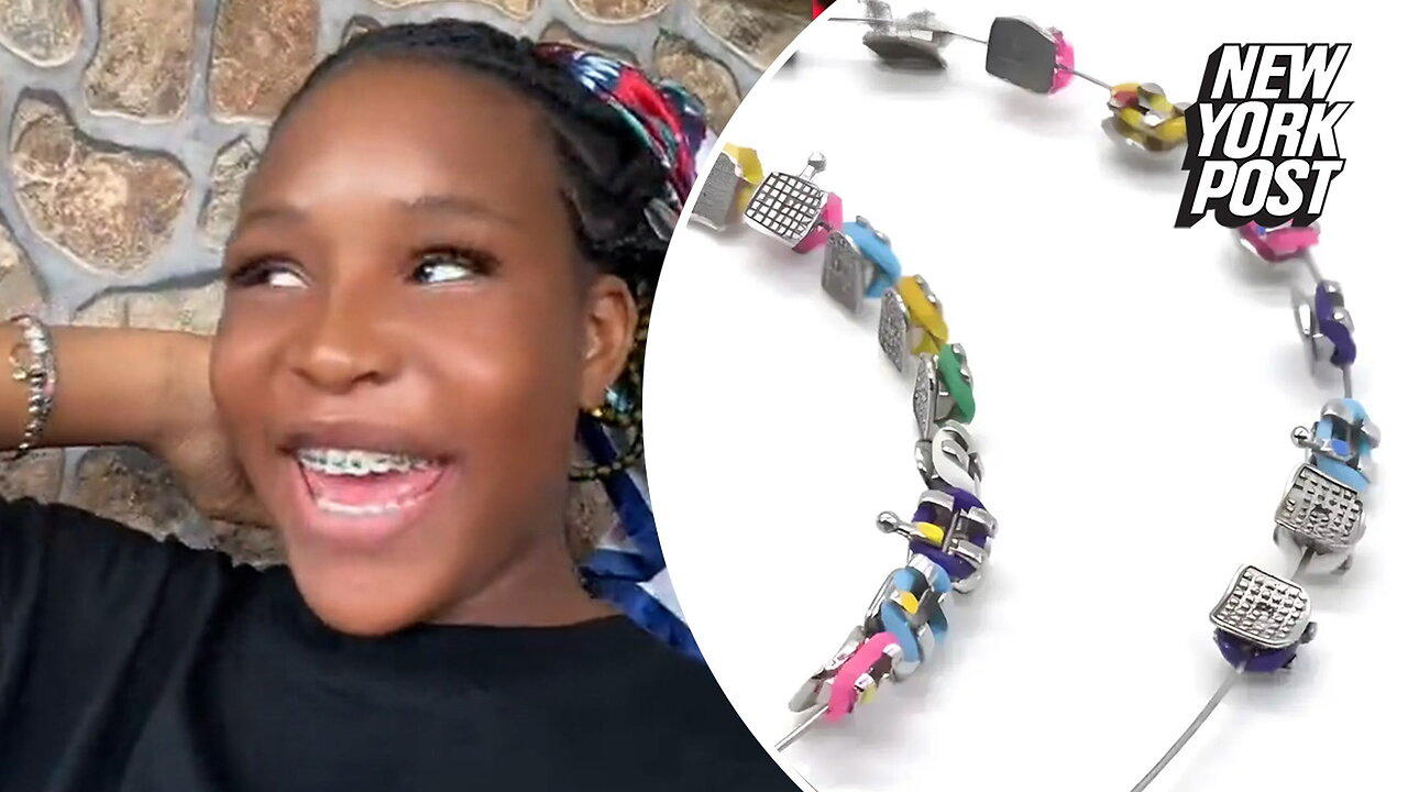 'Fashion braces' rising among young people as hot new accessory