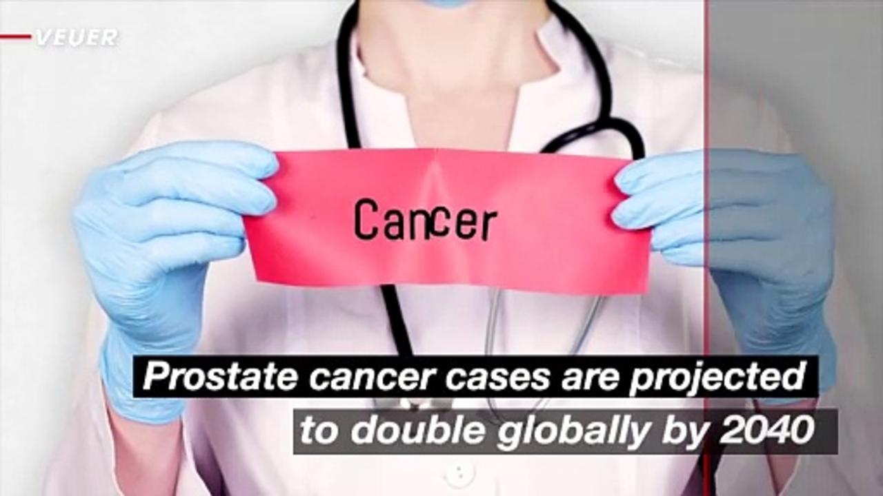 Prostate Cancer Cases to Double by 2040