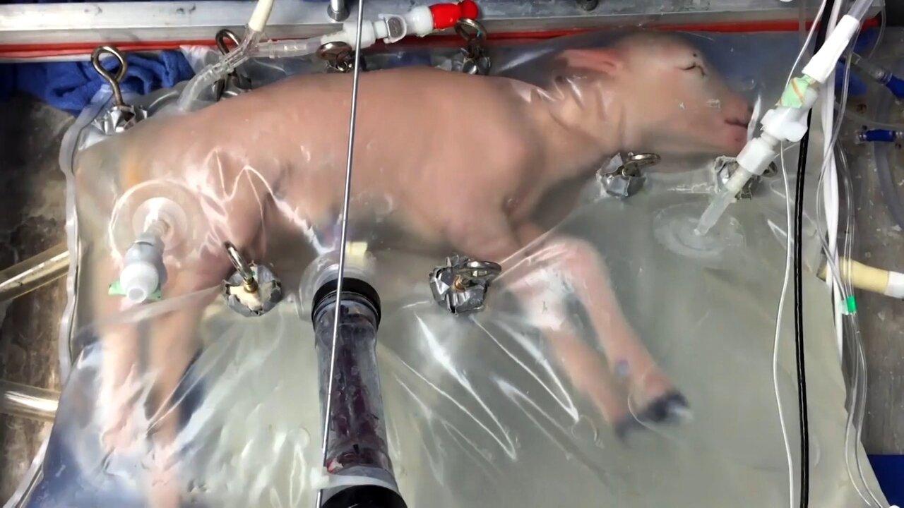 Scientists Grow Lamb Fetus Inside an Artificial Womb