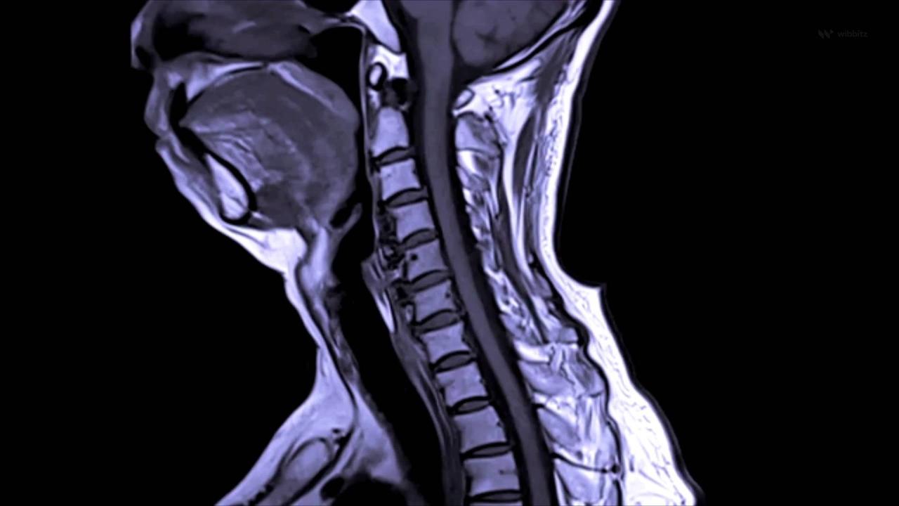 Neuroscience Breakthrough Could Lead to New Treatments for Spinal Cord Injuries