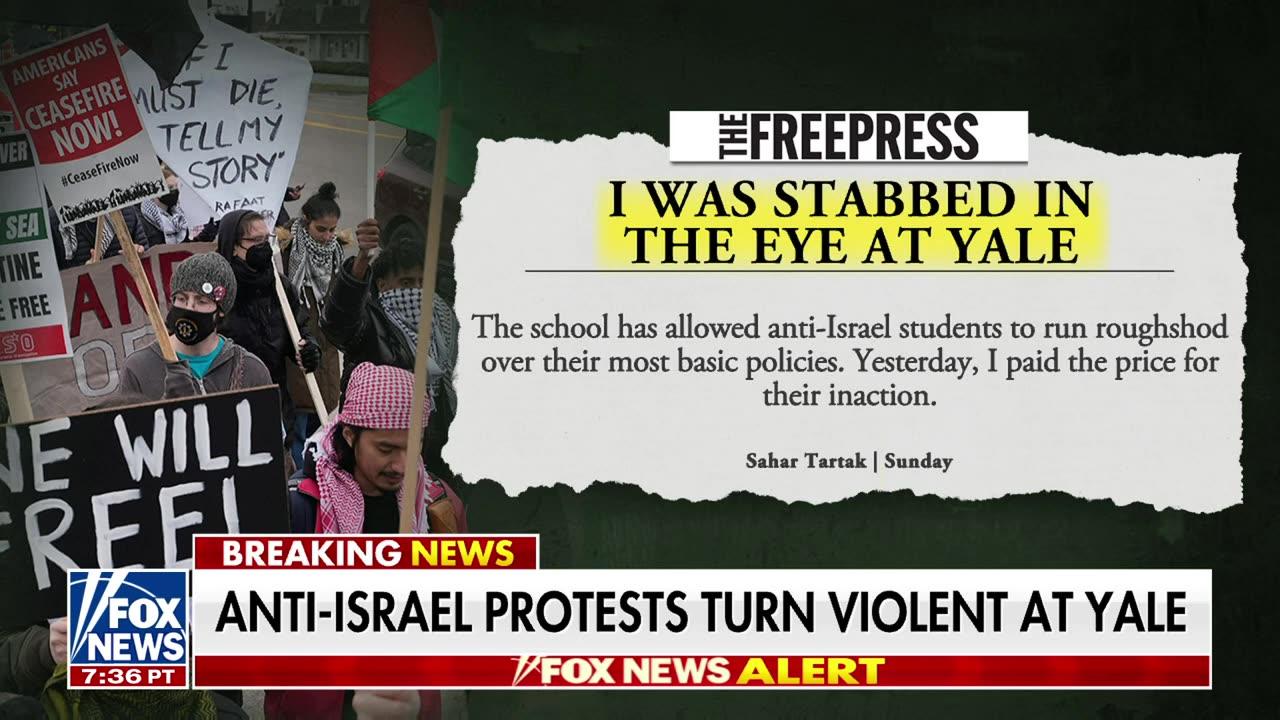 Yale student stabbed in the eye during anti-Israel protest