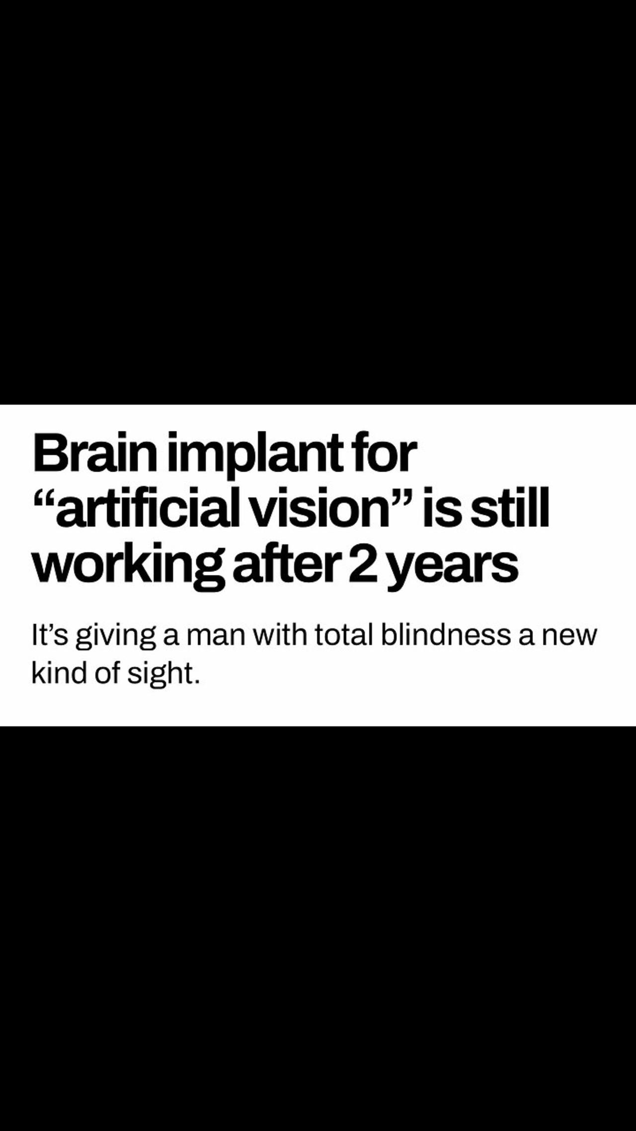 Brain Implant Restores Vision‼️👀