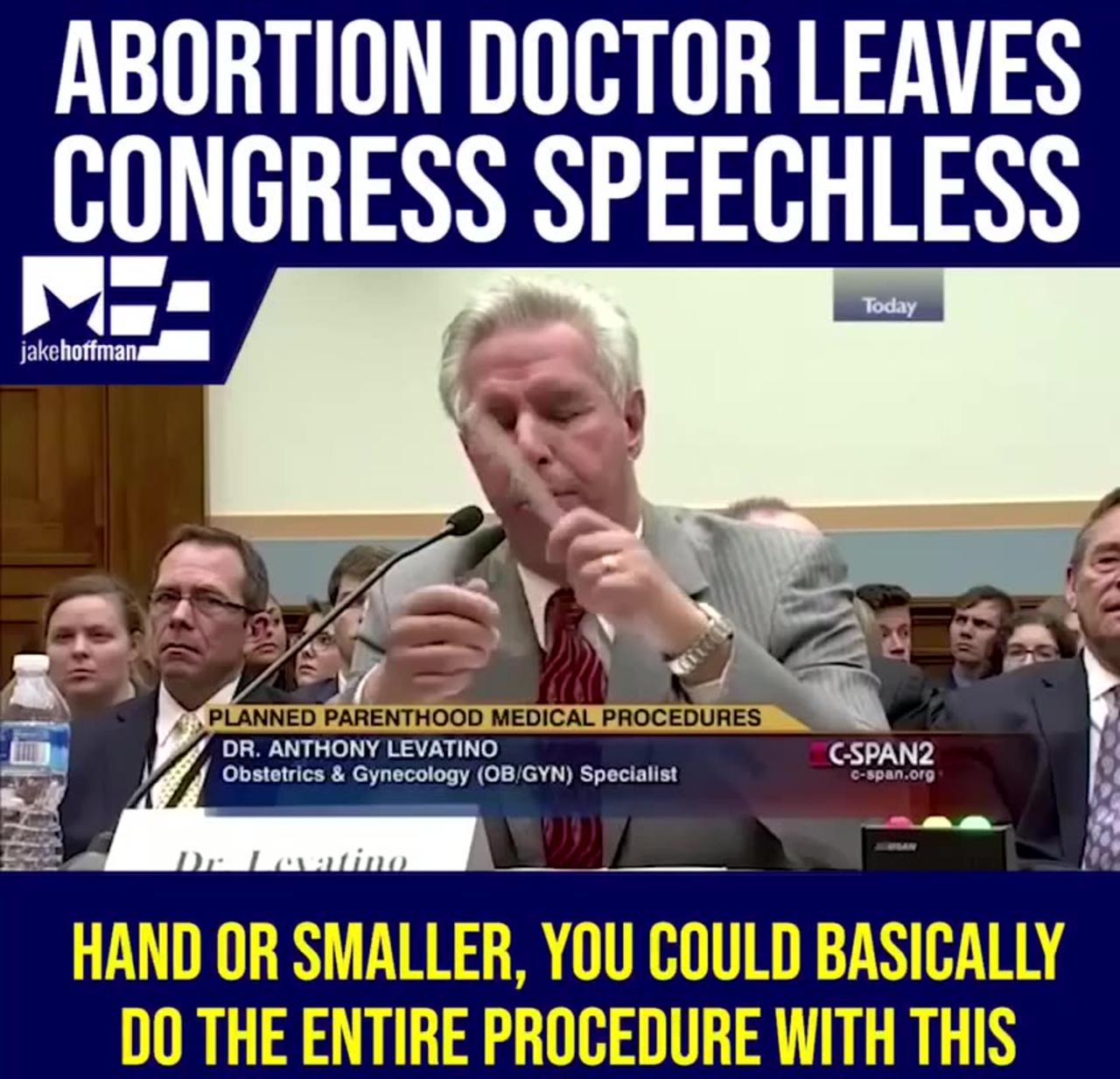 Performing an abortion means tearing a living fetus to pieces