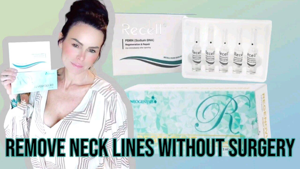 Saggy Wrinkled Neck Treatment / Coupon Code (Holly15) MeamoShop.com / Turkey Neck Youthful Skin DIY