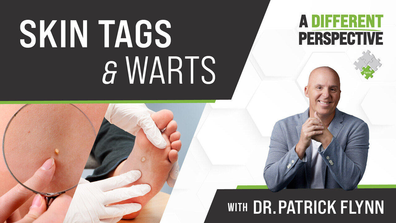 Skin Tags And Warts - Tip-Up Warnings | A Different Perspective | June 15, 2024