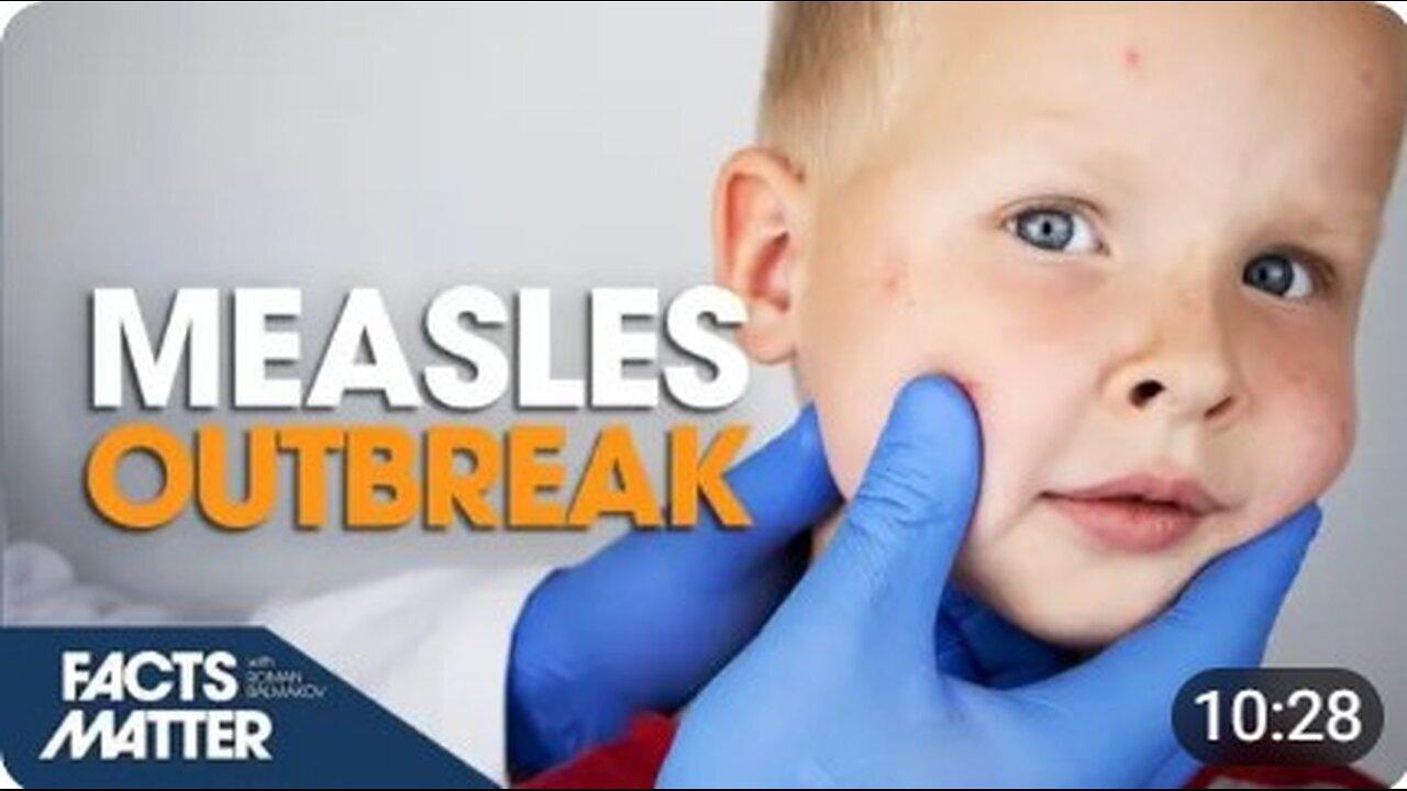 Outbreak of Measles Across US; CDC Reports 100 Percent Spike in Cases