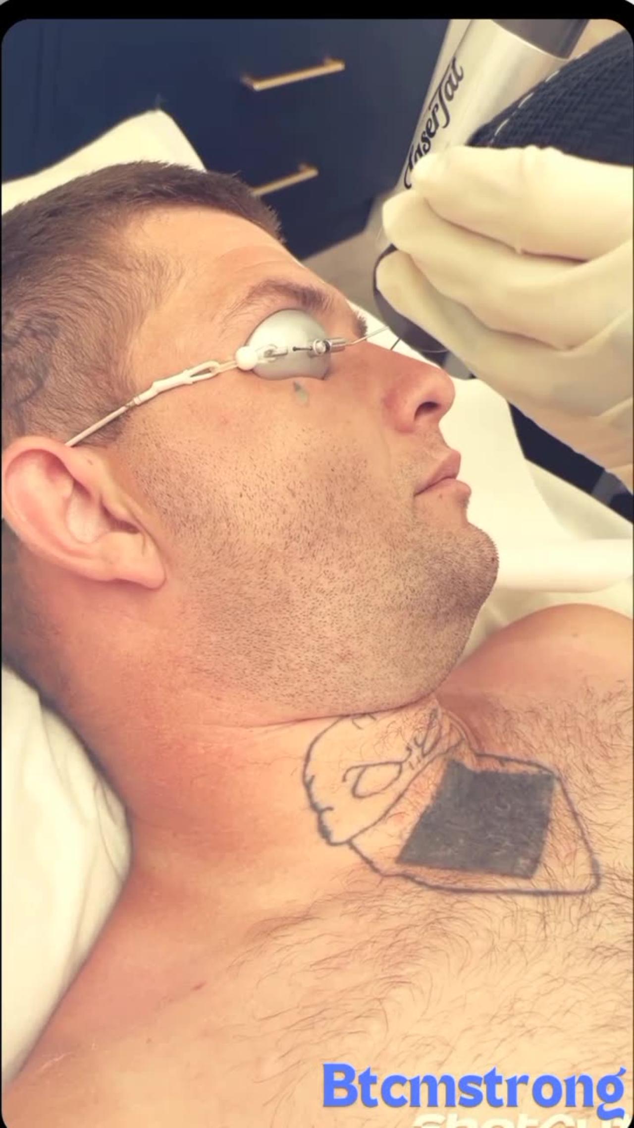 Initial Treatment Progress: Facial Tattoo Removal for Recent Fresh Start Program Participant