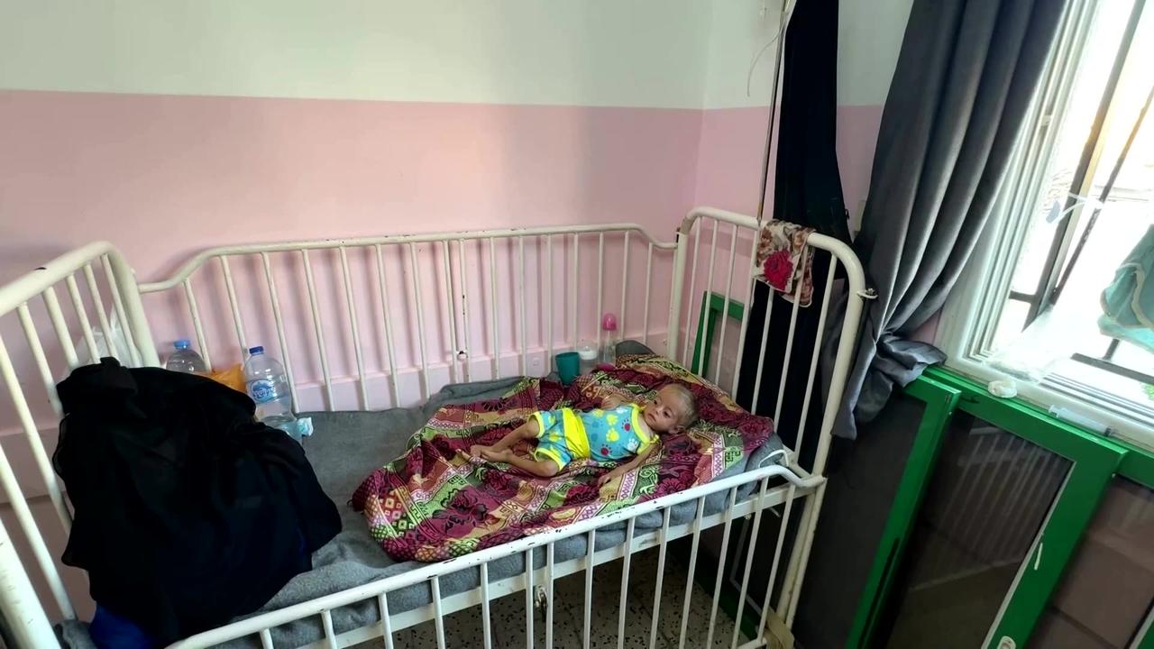 Gazan mother feels powerless to help her malnourished son