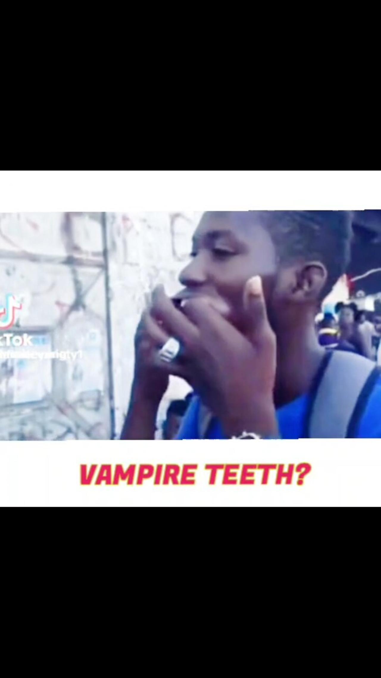 VAMPIRE TEETH?