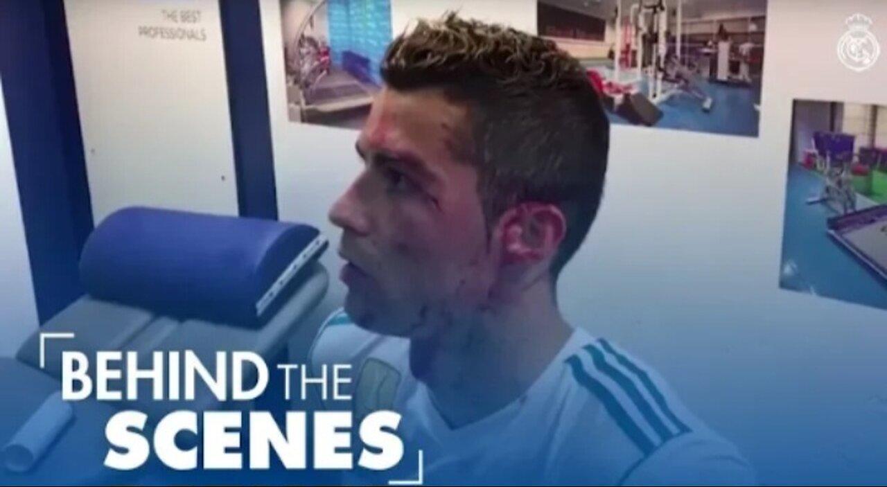 Cristiano Ronaldo INJURY | BLOOD ALL OVER FACE  Real Madrid