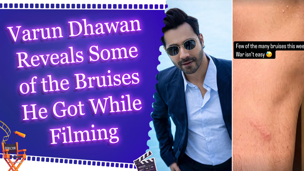 Varun Dhawan Shares a Glimpse of the Multiple Bruises He Endured