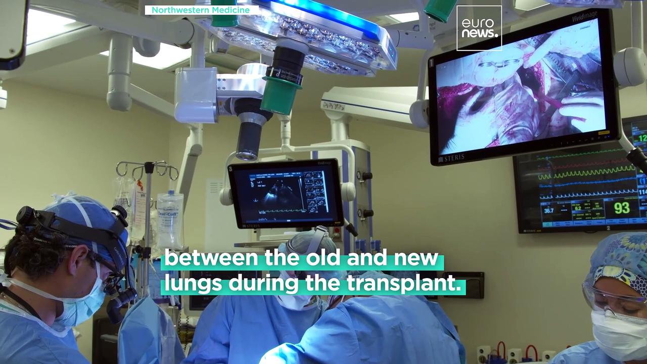 German woman has no signs of cancer after undergoing a new double-lung transplant surgery