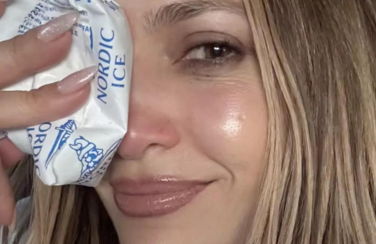Jennifer Lopez experiences a facial injury during rehearsals