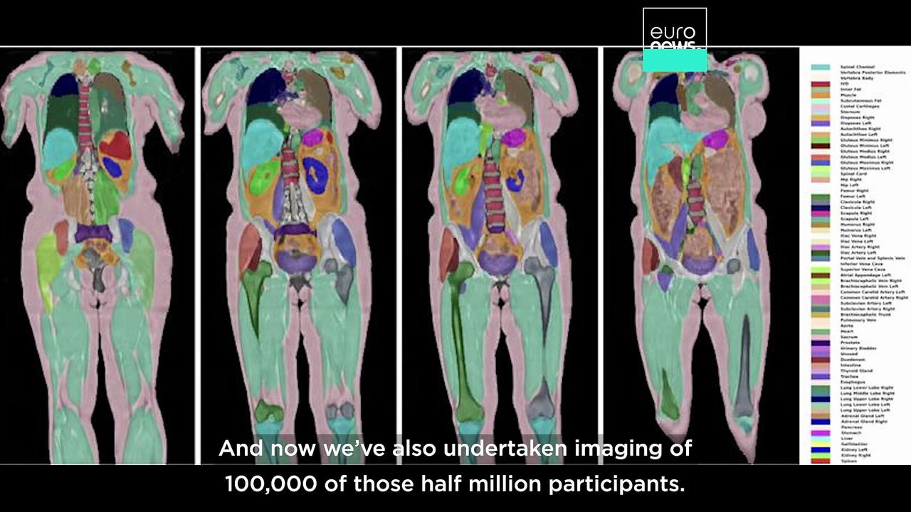 Mass health scan of 100,000 people in the UK could redefine disease diagnosis, scientists say